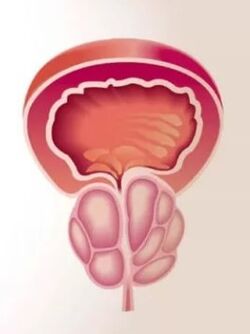 Inflammation of the prostate